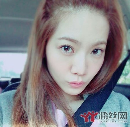 曾之乔整容了吗 曾之乔整容前后对比照