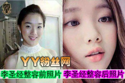 李圣经整容前后照片对比 李圣经透视装图片身材性感超有料