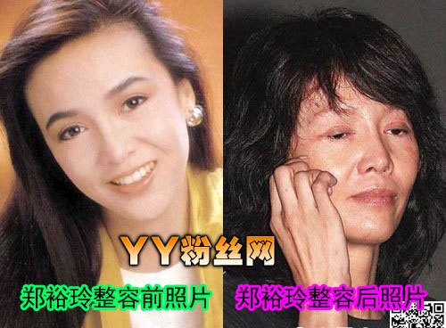 郑裕玲整容前后照片对比 郑裕玲整容照片吓死人
