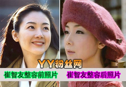 崔智友自杀原因大揭秘 崔智友整容前后照片对比结婚了吗老公是谁