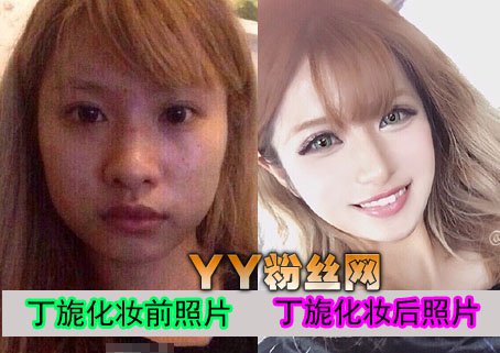 丁旎整容前后照片对比比基尼辣照 模特丁旎与陈柏霖亲密图片曝光