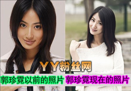 郭珍霓为什么不红老公是谁 郭珍霓个人资料整容前后照片对比男友