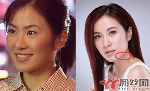 叶璇双眼皮是割的吗 演的孟丽君最好看开了双眼皮之后人气就不行了