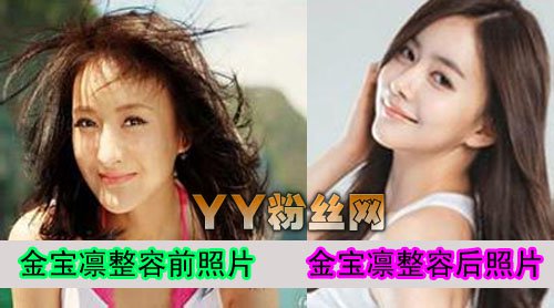 夺命旅行美妍扮演者金宝凛整容前后照片对比 金宝凛不雅照曝光